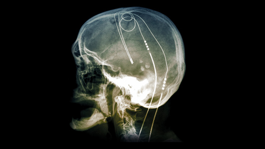  science photo library - c0269906