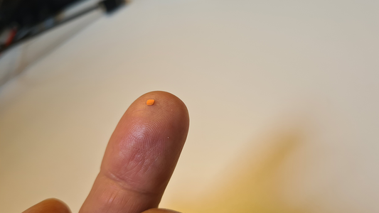 An electronic eye implant has restored central reading vision in patients with sight loss, according to a new study.  - Uncredited