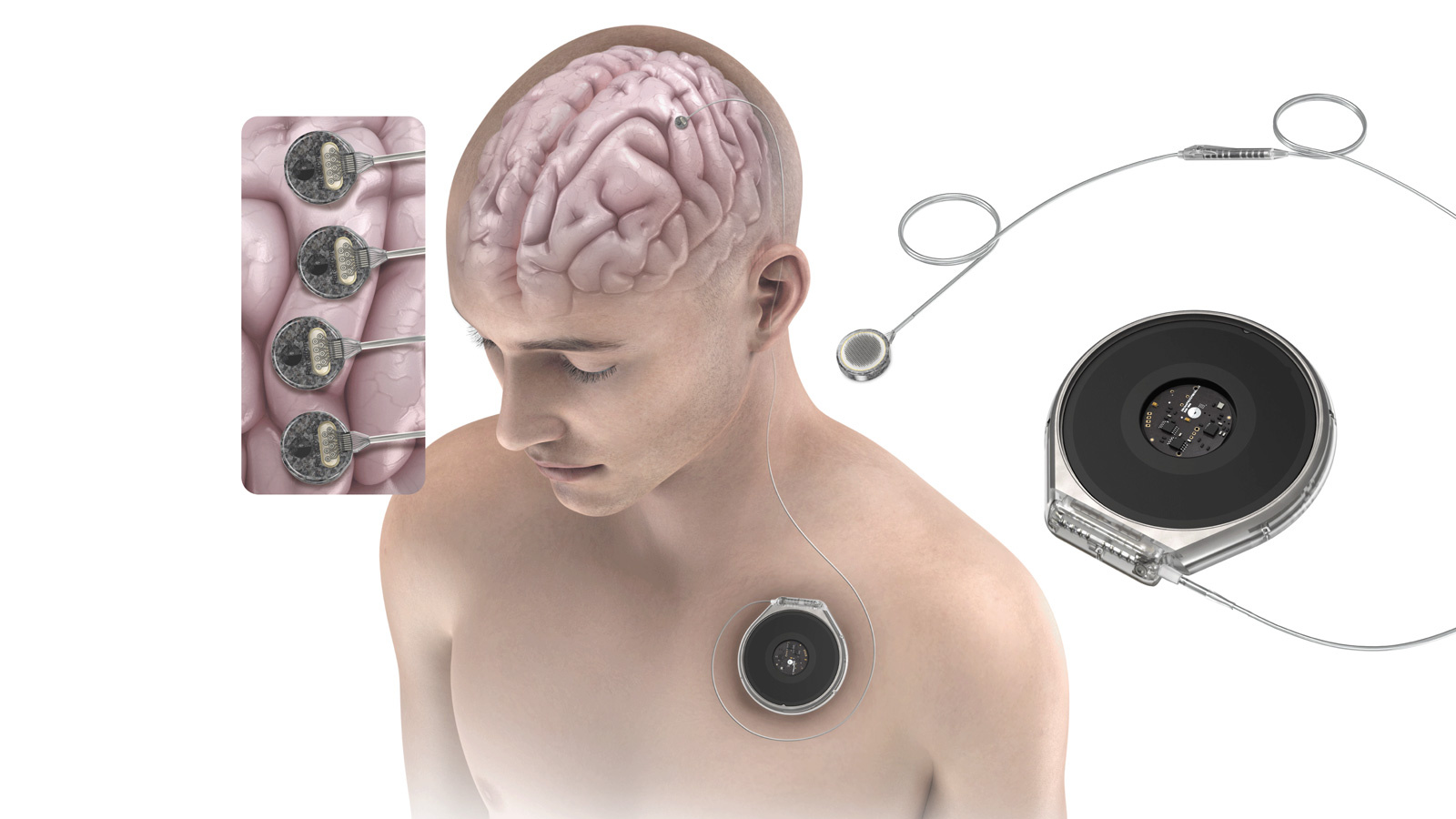 No description provided - Uncredited