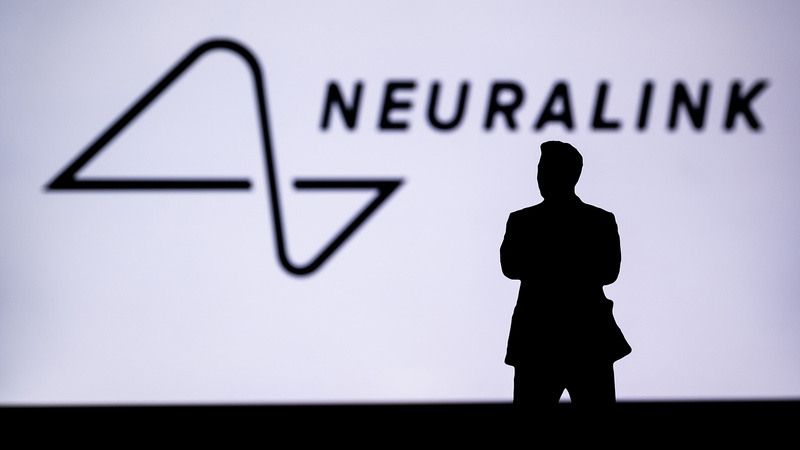 Neuralink builds surgical robot to implant its brain chip in humans